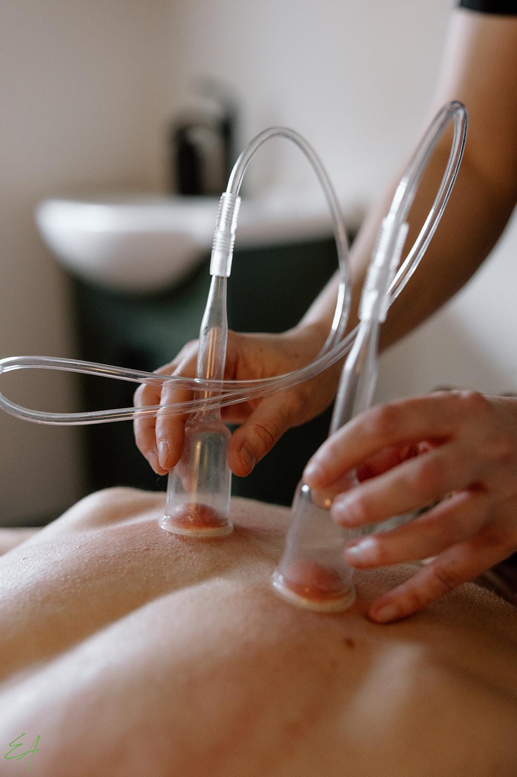 Medi Cupping Therapy