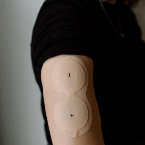 A person shows the NAD+ patch on their upper arm