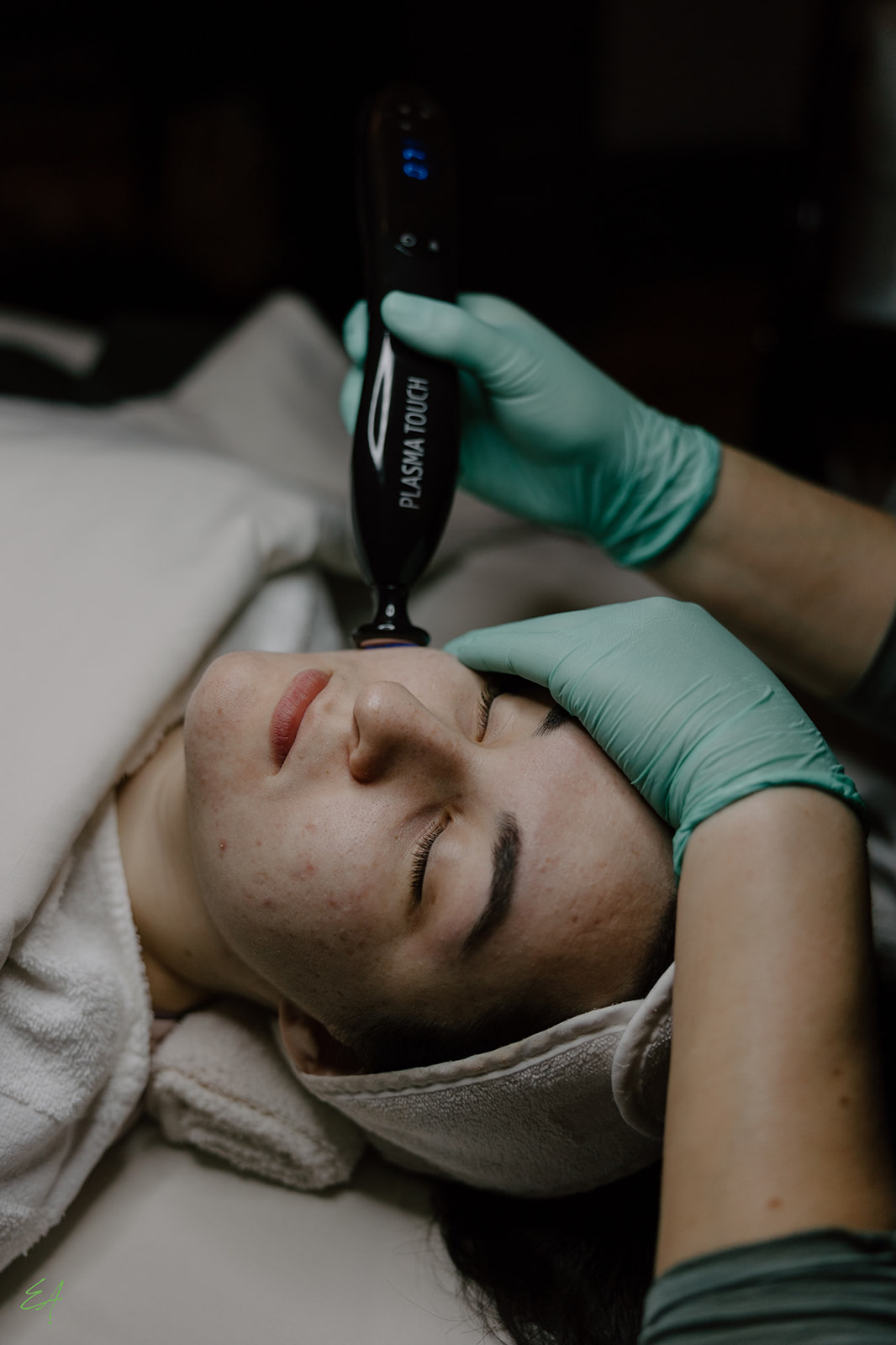 Cold Plasma Facial in session