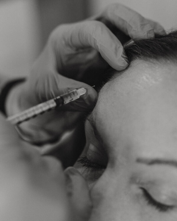 Botox treatment in session